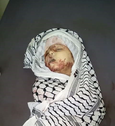 الطفلة "إسراء" ذات العامين والنصف تقضي إثر القصف على مخيم خان الشيح بريف دمشق 