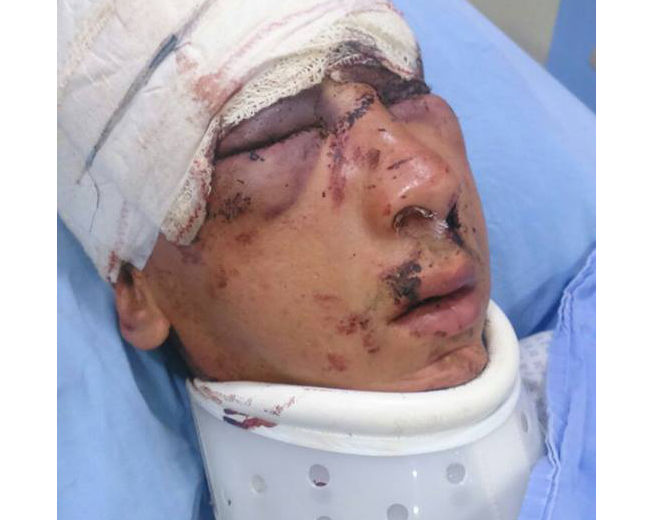 والدة مريض فلسطيني سوري مهجر في لبنان تطلق نداء مناشدة للتكفل بعلاج ولدها