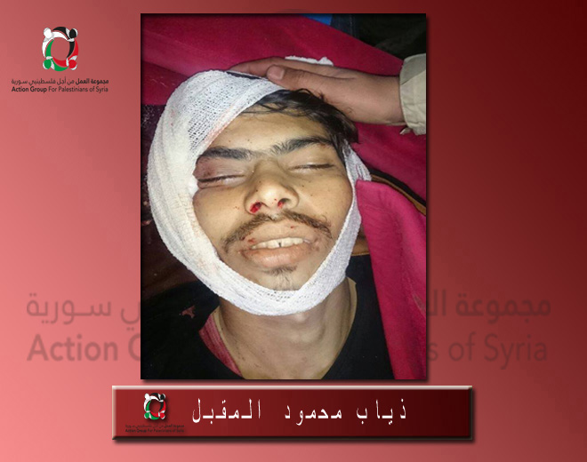 قضاء فلسطيني جراء المعارك المندلعة في حي المنشية بدرعا