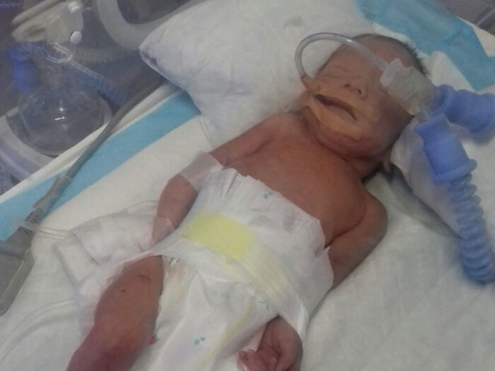 نداء مناشدة من عائلة فلسطينية سورية في لبنان للتكفل بعلاج طفلها الخديج   