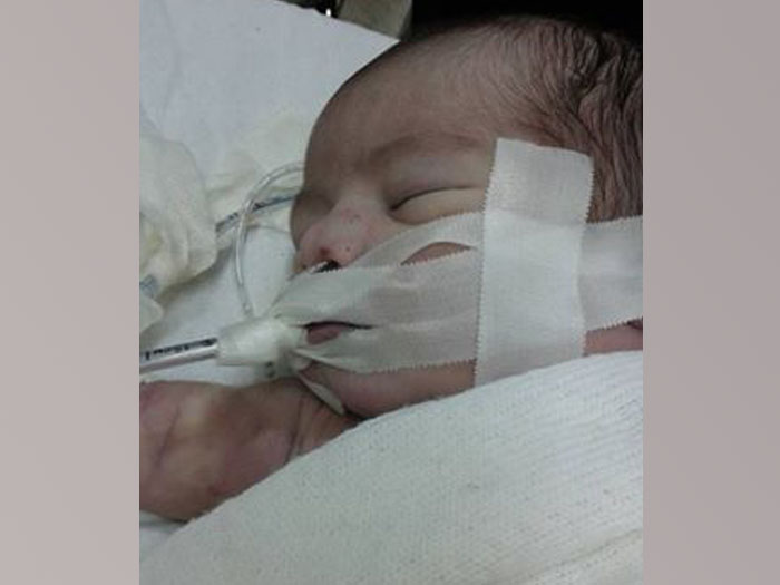 وفاة رضيعة في مخيم اليرموك نتيجة الحصار وسوء الرعاية الطبية 