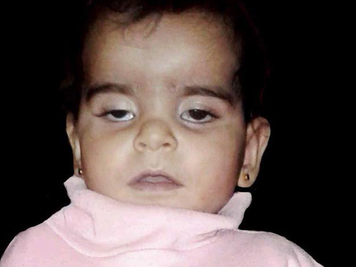 وفاة طفلة رضيعة بعمر سنة في مخيم اليرموك نتيجة الحصار وسوء الرعاية الطبية