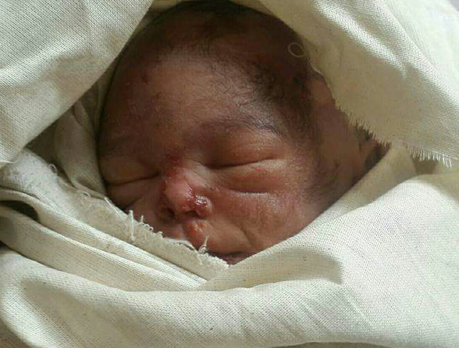 وفاة رضيع بعمر شهرين في مخيم اليرموك نتيجة الحصار وسوء الرعاية الطبية 