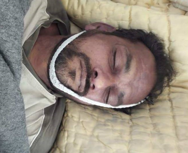 بعد أيام من تهجيره من مخيم اليرموك لاجئ فلسطيني يقضي إثر إصابته بسكتة قلبية 