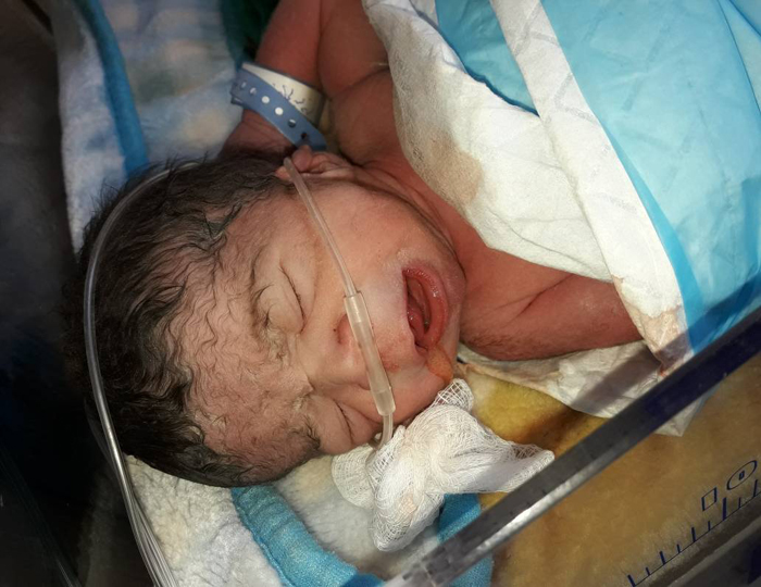 ذوو طفل فلسطيني سوري يطلقون نداء مناشدة لإنقاذ حياة وليدهم