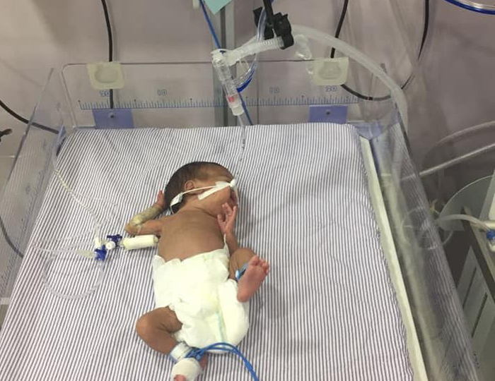 والد طفل فلسطيني سوري يجدد مناشدته للتكفل بعلاج ولده الخديج