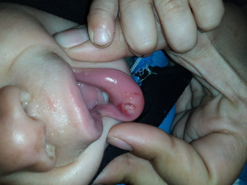 الجرذان تغزو مخيم إعزاز وتثير رعب قاطنيه 