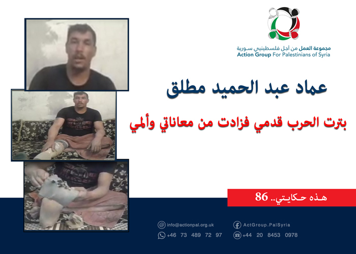 هذه حكايتي (86)|| عماد عبد الحميد مطلق بترت الحرب قدمي فزادت من معاناتي وألمي 