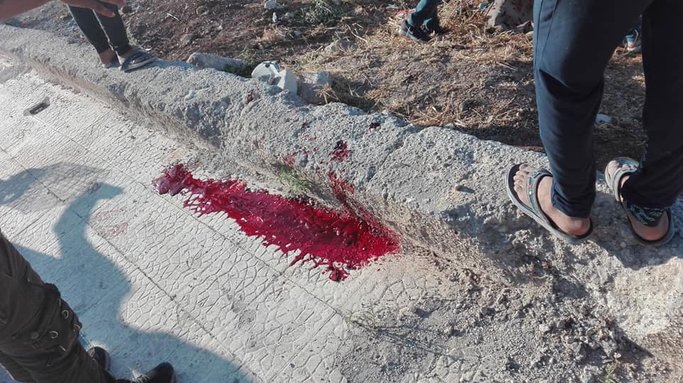 انفجار قنبلة عنقودية تودي بحياة طفل في مخيم حندرات بحلب 