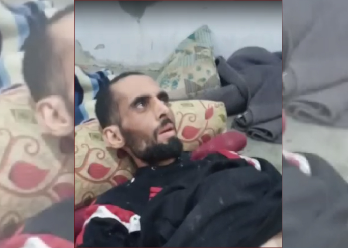 الشمال السوري.. الموت يهدد حياة فلسطيني ومناشدات لنقله للعلاج في تركيا    