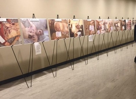 في اليوم الدولي لمساندة ضحايا التعذيب. عائلات ضحايا التعذيب الفلسطينيين في سورية تطالب بجثامينهم