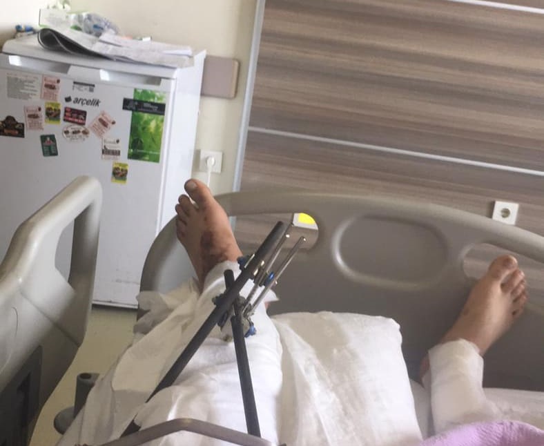 تركيا.. مريض فلسطيني يناشد التكفل بعلاجه 