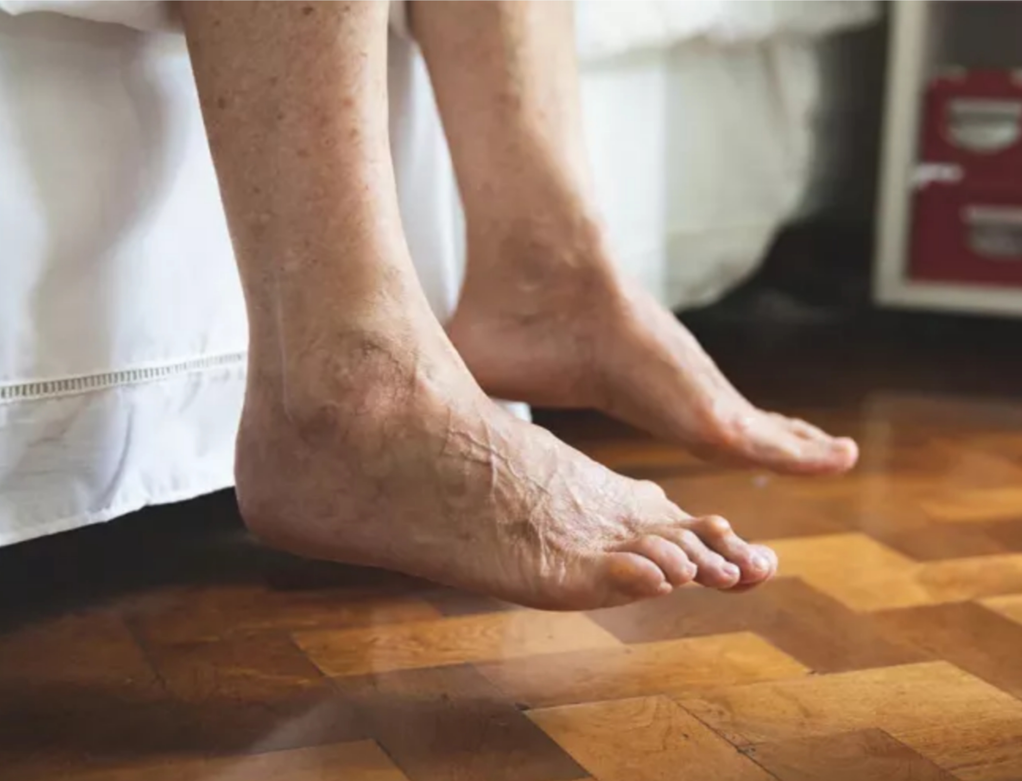 مخيم خان الشيح.. مناشدة لإنقاذ قدم مريض من البتر