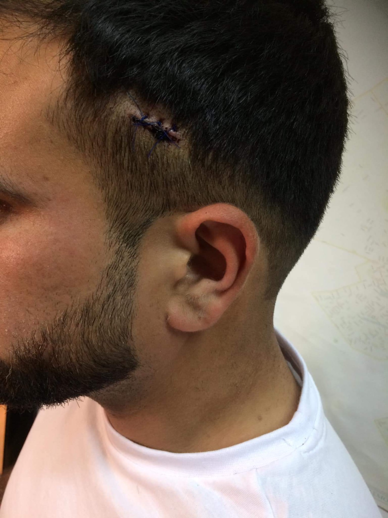 مهاجرون فلسطينيون من سورية يشكون اعتداءات عنصرية في اليونان