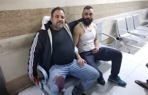 إصابة ثلاثة فلسطينيين من لواء القدس خلال القبض على مجرم احتجز طفلتيه