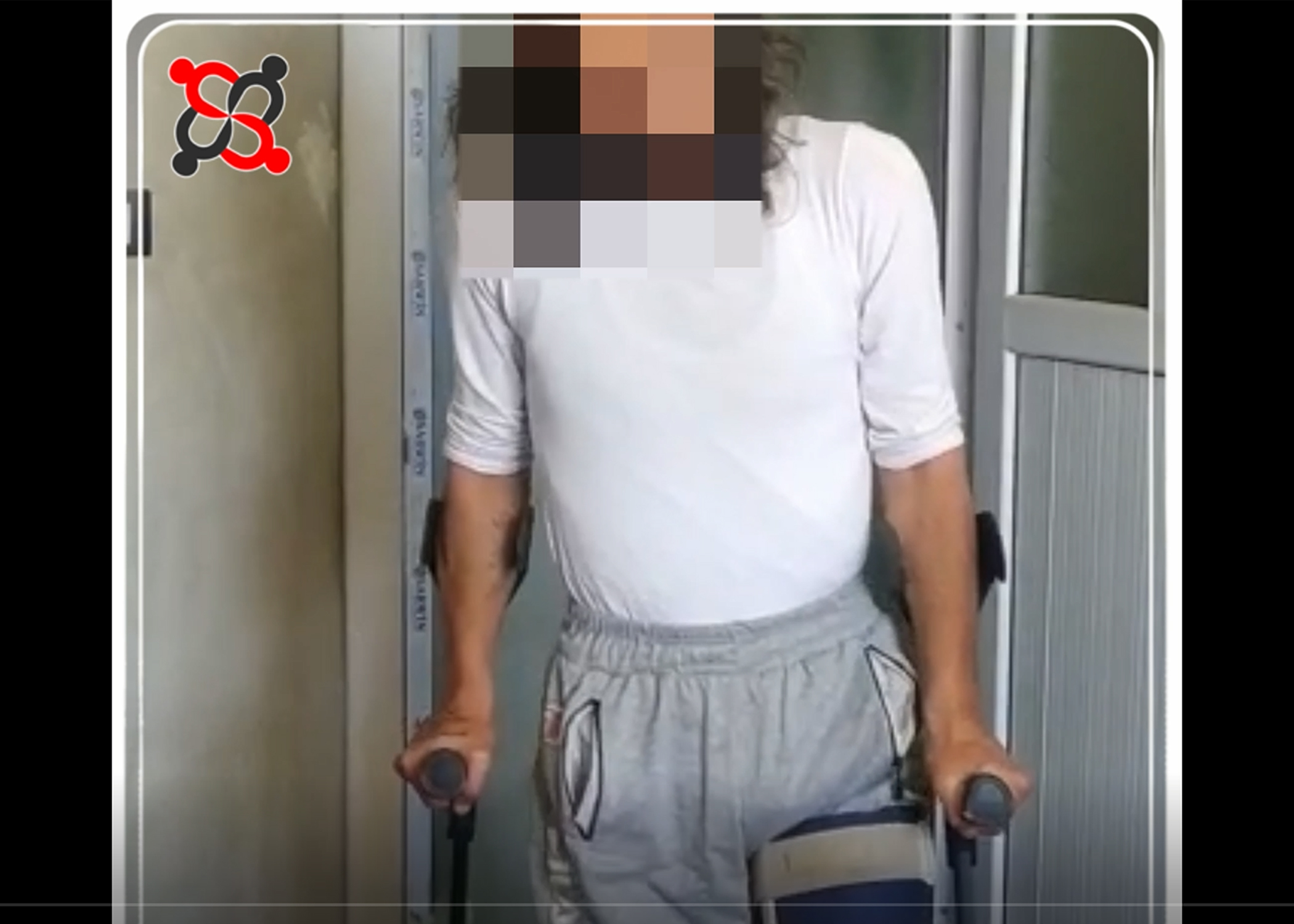 شاهد: فلسطيني سوري مهجر إلى إدلب يروي مأساته وتفاصيل اصابته واعتقاله 