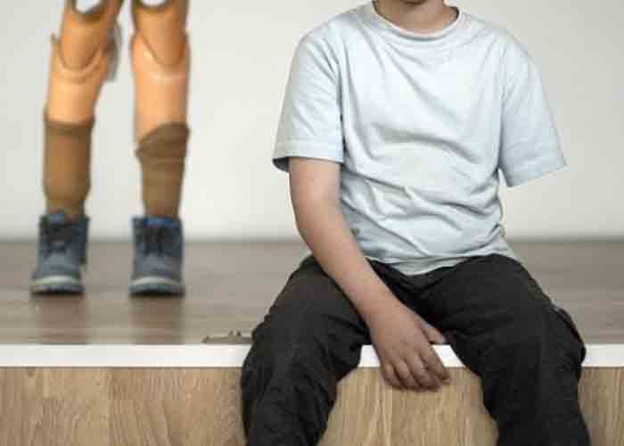 جرحى الحرب الفلسطينيون في سوريا.. مأساة بلا نهاية