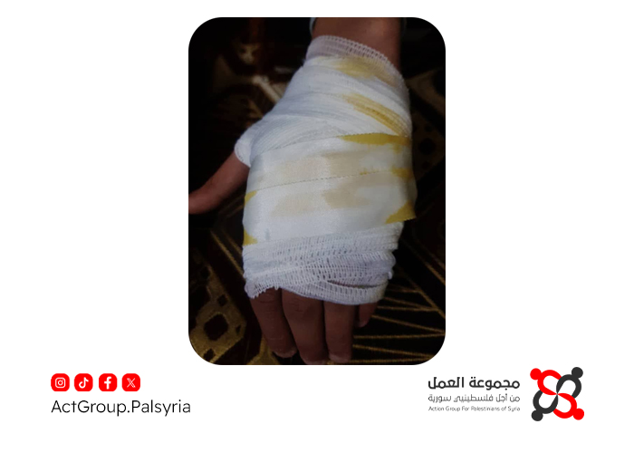 طعن ومحاولة سلب في مخيم النيرب. والأمن يلقي القبض على أحد المتورطين