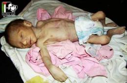 توثيق (190) ضحية من الفلسطينيين قضوا تحت الحصار