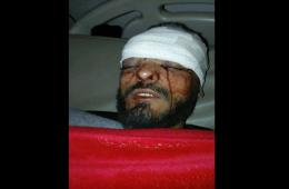 إصابة شاب فلسطيني إثر الاشتباكات بين المعارضة السورية المسلحة وقوات النظام في درعا 