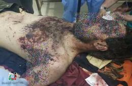 انفجار اسطوانة غاز يسفر عن وفاة أحد أبناء مخيم درعا جنوب سورية