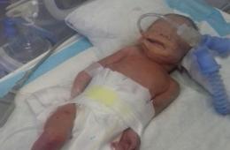 نداء مناشدة من عائلة فلسطينية سورية في لبنان للتكفل بعلاج طفلها الخديج   