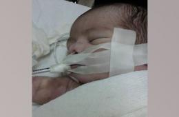 وفاة رضيعة في مخيم اليرموك نتيجة الحصار وسوء الرعاية الطبية 