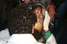 "24" فلسطينياً سورياً قضوا خلال شهر أيلول 2017.. و"43" ضحية في الشهر ذاته 2016