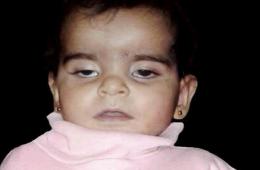 وفاة طفلة رضيعة بعمر سنة في مخيم اليرموك نتيجة الحصار وسوء الرعاية الطبية