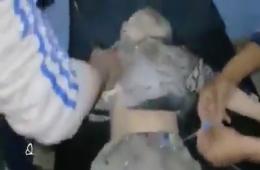 طفلة تقضي وإصابة 8 مدنيين إثر قصف بلدة يلدا يوم أمس