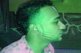 قضاء أحد عناصر جيش التحرير الفلسطيني في معارك درعا