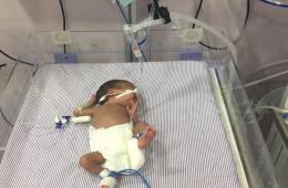 والد طفل فلسطيني سوري يجدد مناشدته للتكفل بعلاج ولده الخديج