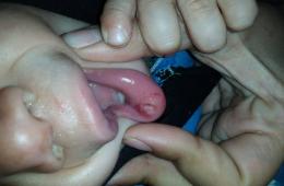 الجرذان تغزو مخيم إعزاز وتثير رعب قاطنيه 