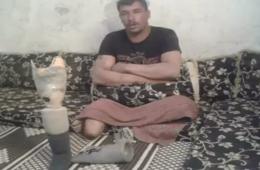 نداء مناشدة للتكفل بتأمين قميص طرف صناعي للاجئ فلسطيني من أبناء مخيم درعا 