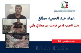 هذه حكايتي (86)|| عماد عبد الحميد مطلق بترت الحرب قدمي فزادت من معاناتي وألمي 