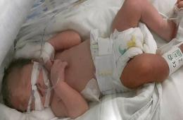 تركيا.. أب يناشد للتكفل بعلاج طفله الخدج 