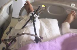 تركيا.. أحد أبناء مخيم اليرموك قد تبتر قدمه لعجزه دفع مصاريف العلاج