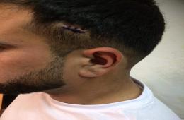 مهاجرون فلسطينيون من سورية يشكون اعتداءات عنصرية في اليونان