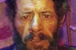 شاهد: فلسطيني في الشمال السوري إصابتي حولت حياتي لجحيم وفاقمت مأساتي 