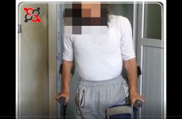 شاهد: فلسطيني سوري مهجر إلى إدلب يروي مأساته وتفاصيل اصابته واعتقاله 