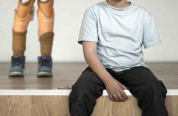 جرحى الحرب الفلسطينيون في سوريا.. مأساة بلا نهاية