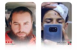 إصابة شابين فلسطينيين من صفوف الأمن العام خلال اشتباكات مع فلول النظام