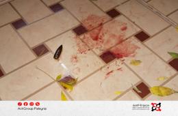 مخيم خان الشيح. إصابة طفلة بطلق ناري بسبب السلاح المنفلت  مجموعة العمل