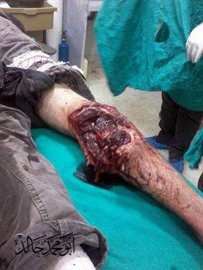 قصف مدفعي على بلدة مزيريب 