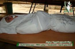 فلسطينية تقضي بسبب الحصار في مخيم اليرموك، وارتفاع حصيلة ضحاياه إلى (163)