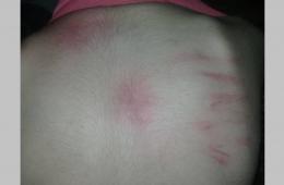 ذوو طالب في مخيم خان دنون يشكون إساءة معاملة أحد المدرسين